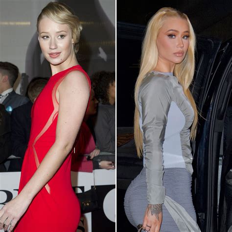 iggy azalea fake butt|Iggy Azalea Responds to Butt Implant Rumors: Watch